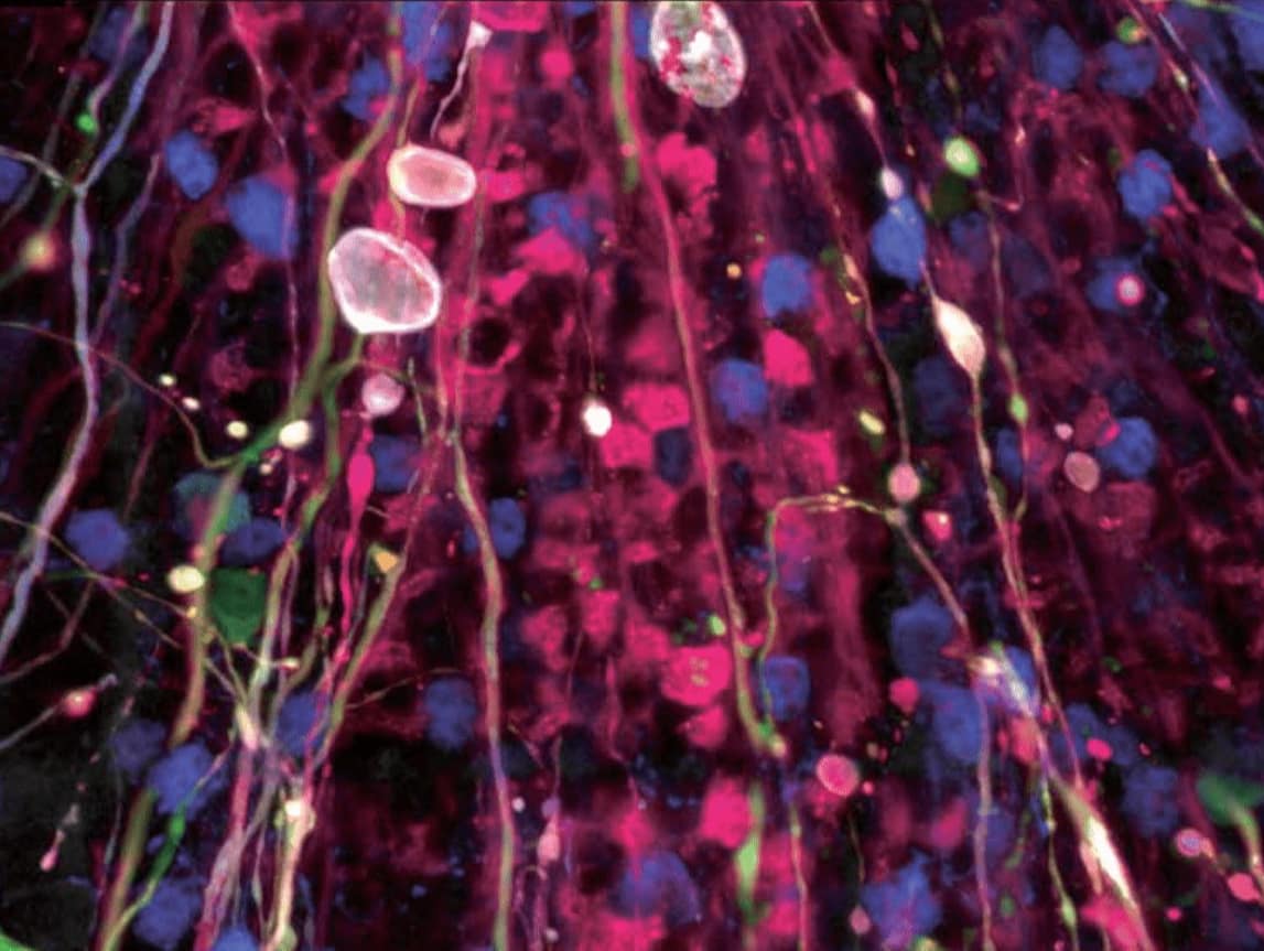 20211201 B9074d06590ff54211da7412c04d636d